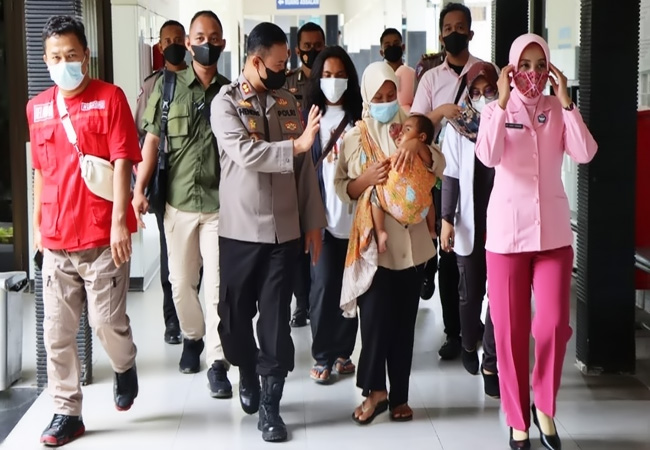 Kisah Pilu Bayi 17 Bulan Penderita Tumor Mata di Banjarnegara